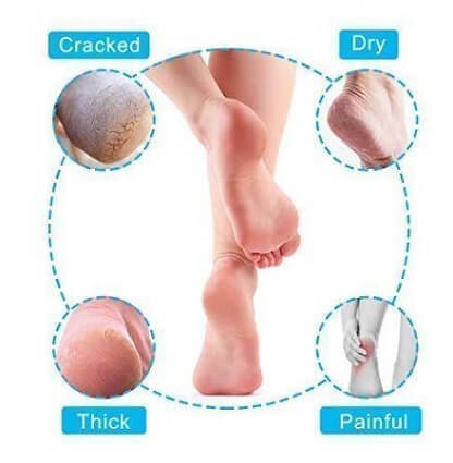 PEDI_SOCKS_GALLERY_IMG2