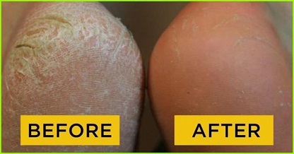 PEDI_SOCKS_GALLERY_IMG6