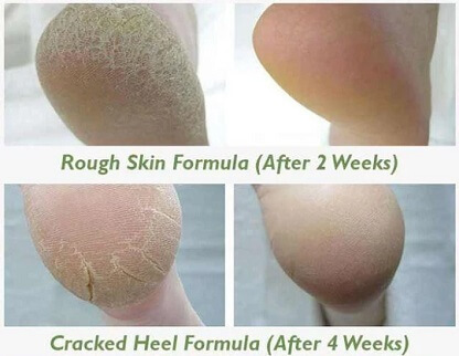 PEDI_SOCKS_GALLERY_IMG7